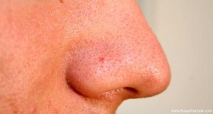 13cad83032aa527ce81409b6748c1471