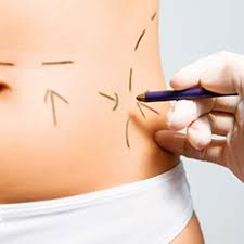 عمليات شفط الدهون و اثارها علي الصحة