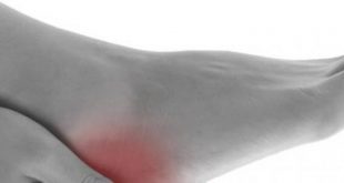 الأملاح الزائدة في الجسم